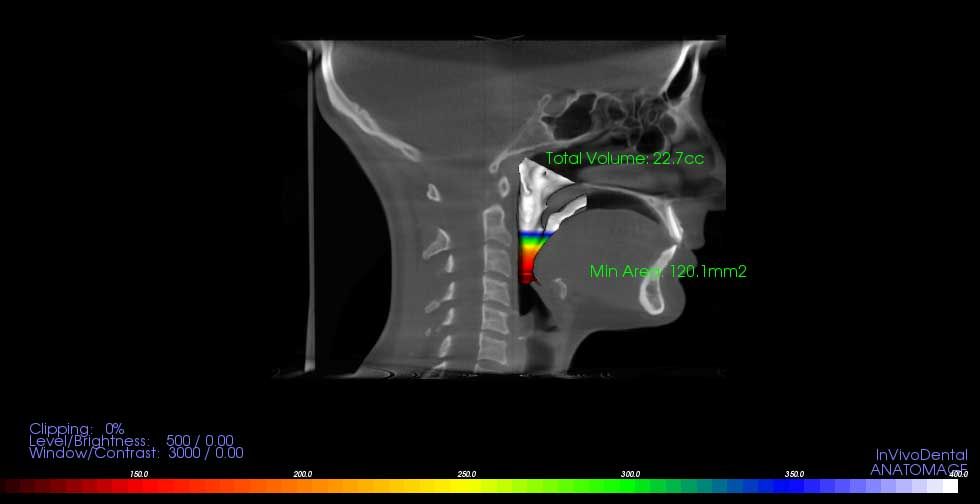 компьютерная томография КТ в клинике БИЭМ Санкт-Петербург