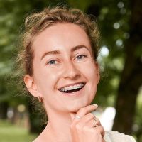 брекеты у взрослой женщины