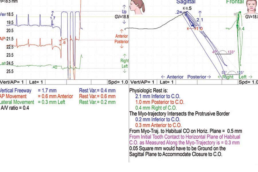 gnatographia-myotronics-K7