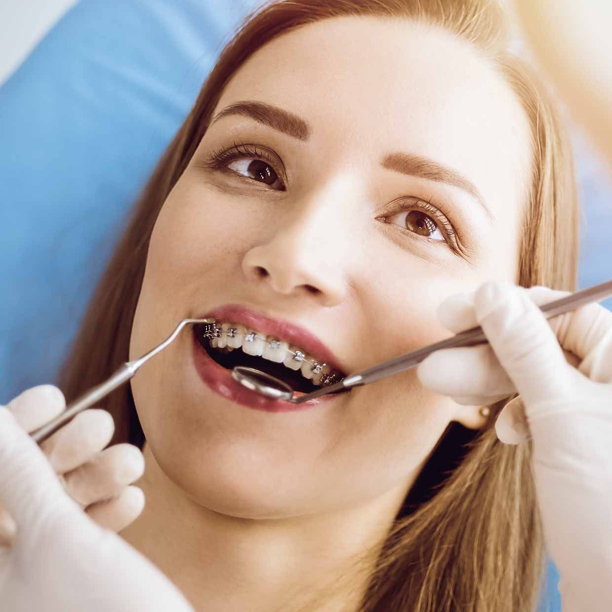 металлические брекеты