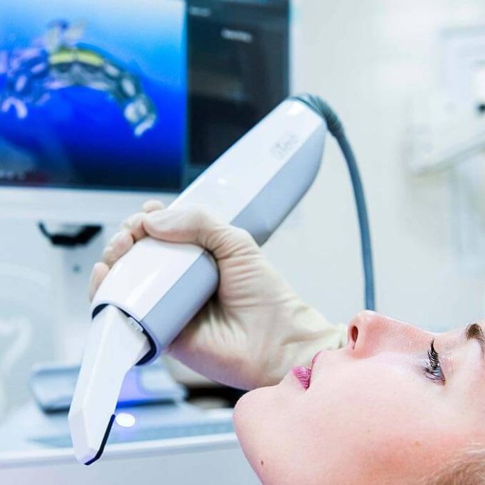 iTero сканирование в БИЭМ