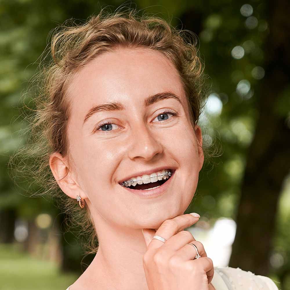 брекеты у взрослой женщины