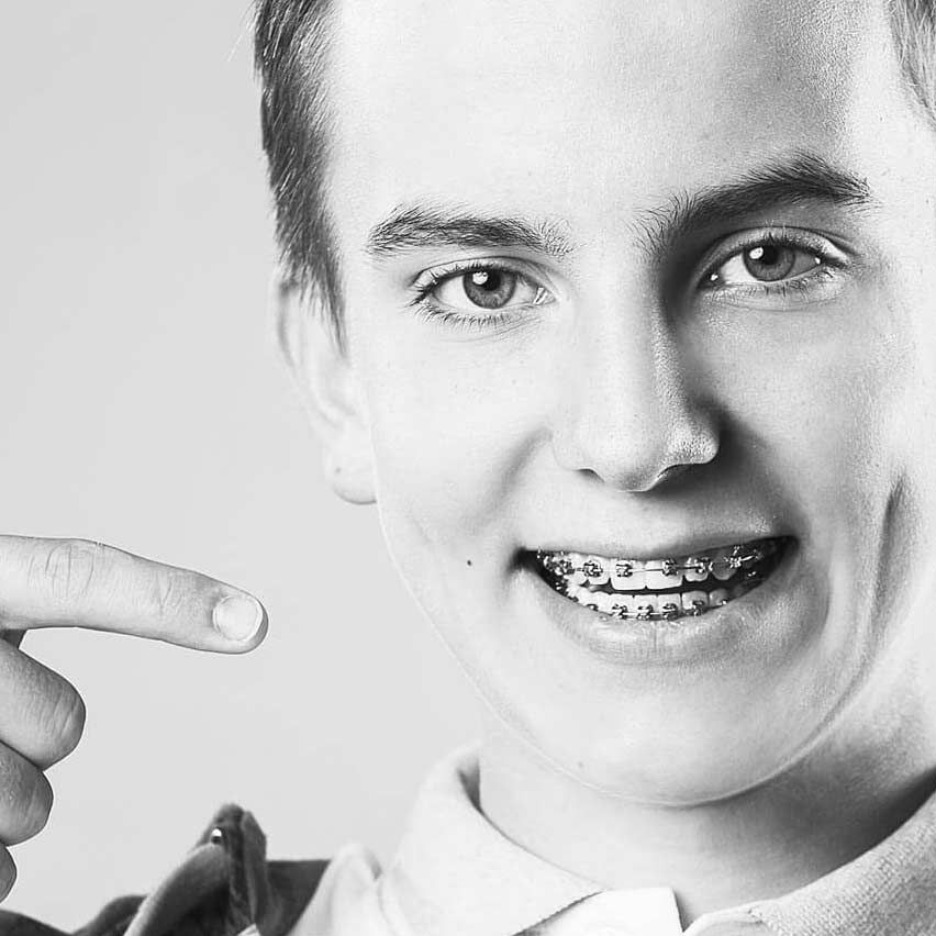 Пациент БИЭМ с брекетами