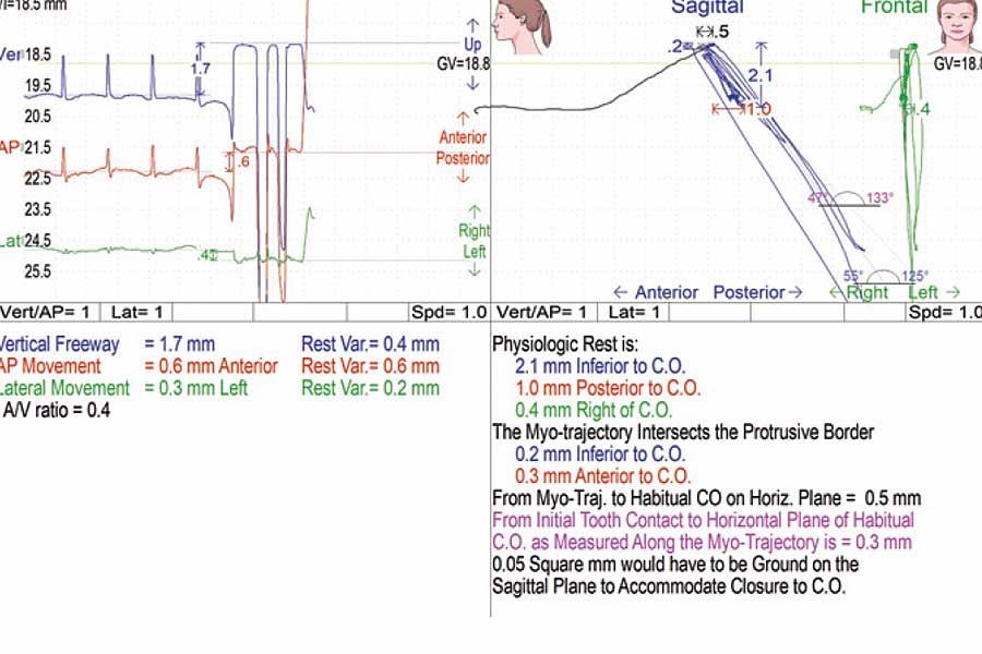 gnatographia-myotronics-K7