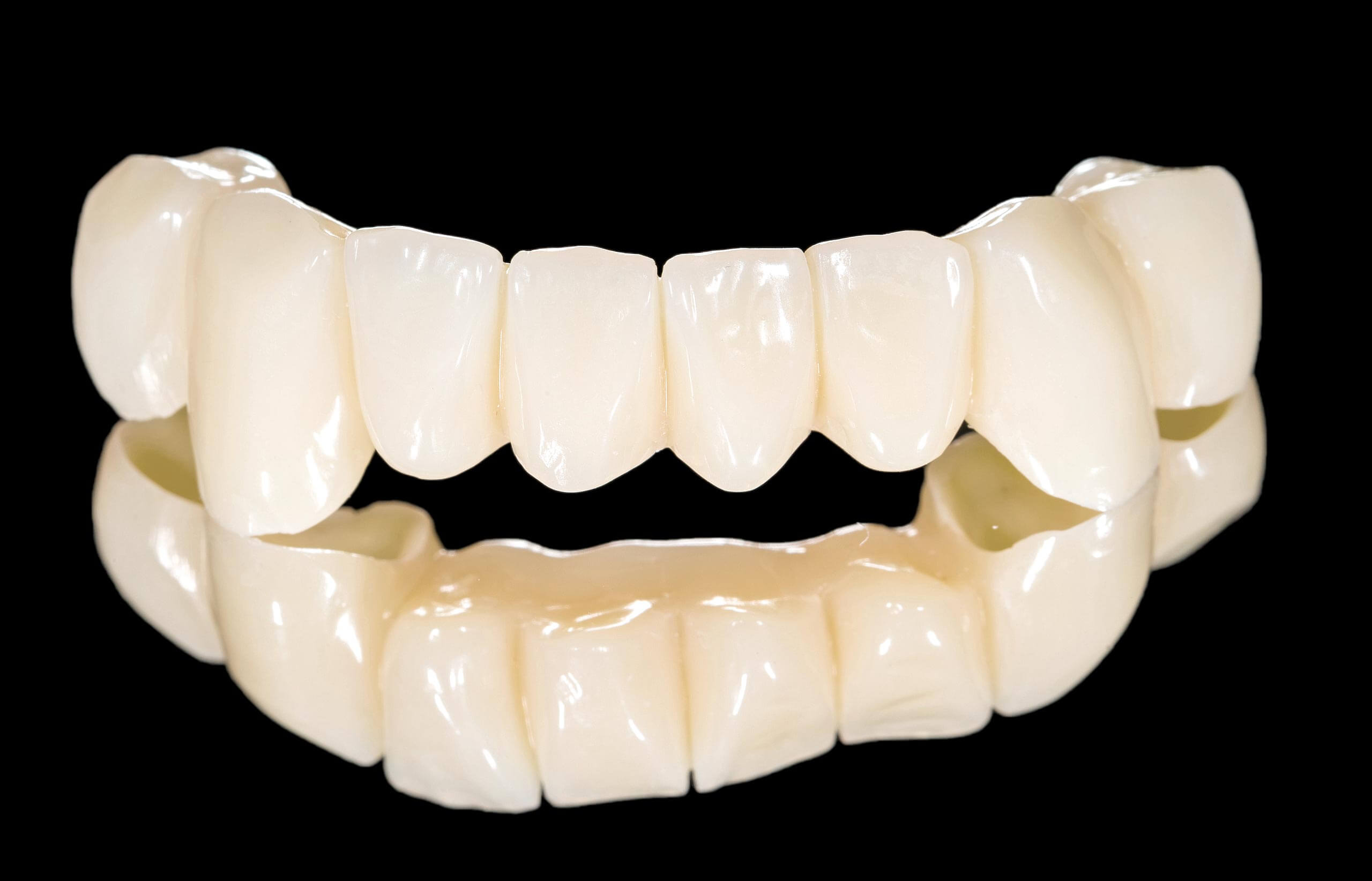 Зубной мост: что это такое в стоматологии, как выглядит на зубах и как ставят протез